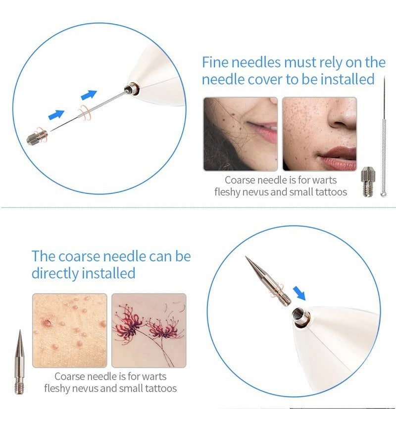 Lápiz Plasma Para Manchas Lunares Y Pecas