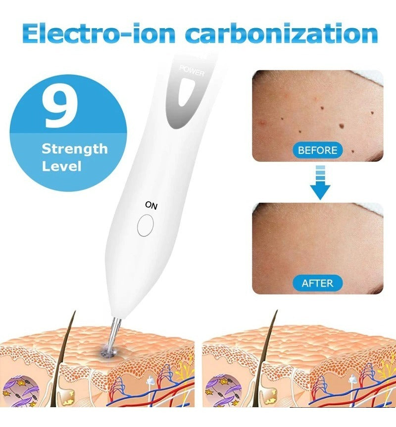 Lápiz Plasma Para Manchas Lunares Y Pecas